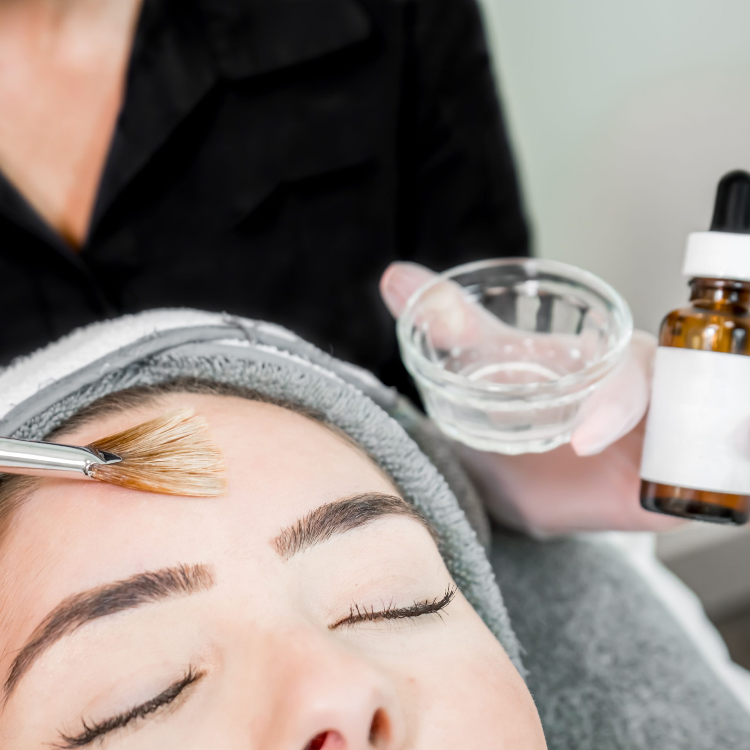 Chemical Peel MD365