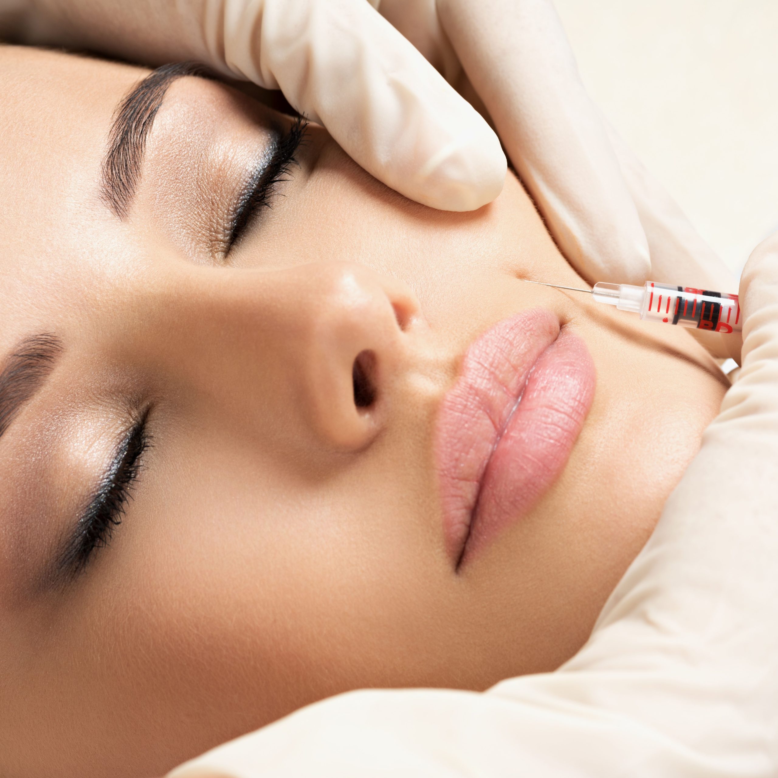 Dermal Fillers