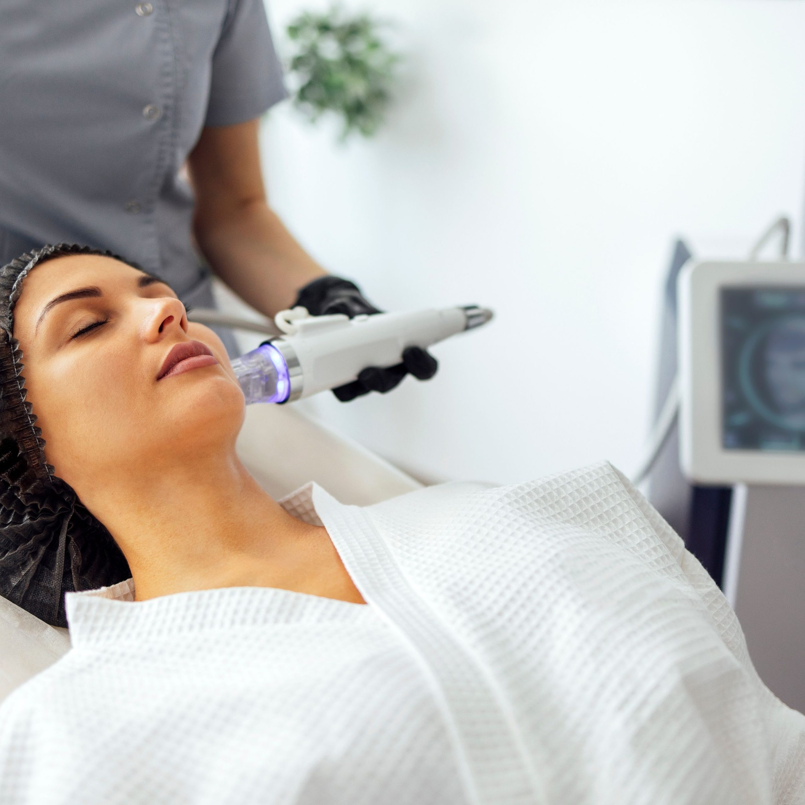 RF Microneedling MD365