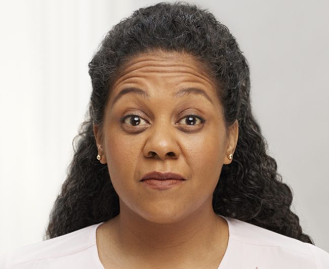 Wrinkle Relaxers Before and After - Case 4, Image 3 - Female, age 35 – 44 - East Moriches, NY - MD365 Aesthetics